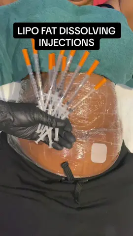 Lets get snatched for this summer 💃💃 #sedisglowbar #snatched #fatdissolving #lipoinjection #fatdissolvinginjectionsouthafrica #fatdissolving #weightloss #gauteng #mokhabainjections #flattummy #fyp #tiktoksouthafrica #jhbtiktokers #SAMA28 #laserlipo #cavitation #healthyweightloss