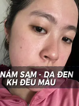 Không còn là nổi lo của các cô gái khi sử dụng #combofacev2 #tinhchatbakuchiol #kemfacecollagencáhồi #duongtrang #meea #thohuynhmeeaorigin 