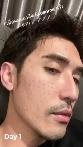 หน้าหรือกระจก ✨ ชอบมาก #บิ๊กเอ็มกฤตฤทธิ์ #BigMKrittarit #Exosome #GlassySkin 