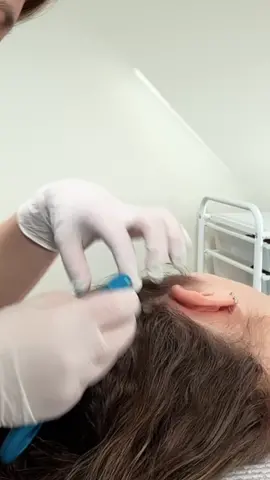 ASMR part 3 ~ face and scalp checkup most relaxing scalp session #asmr_tingles #asmrscalpcheck #asmrscalpexamination #asmrscalptreatment #asmrfacetouching #asmrfaceexam #asmrdoctorroleplay #asmrmedicalexam #asmrhairplay #asmr_tingles #asmrmedicalexam #asmrsensory #asmrrealperson #madpasmr #asmrunintentional #asmrsharpordull #asmrdoctor 