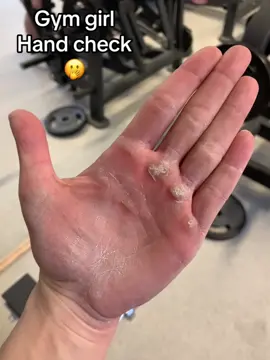 Unghie quasi nuove e back day 🤤 #gym #palestra #fyp #fypシ #gymgirl #calluses #callus #callusremoval #callusremover #hand #check #mano #callo #calli 