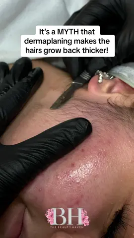 Its a MYTH the hair doesnt grow back thicker! Wait until the end to see her after! #dermaplaning #dermaplaningfacial #thebeautyhaven__ #estheticiantiktok #londonfacialist 