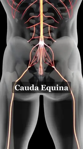 What Is Cauda Equina How Does It Affect Your Spine #3d #animation #caudaequina #health #anatomy 