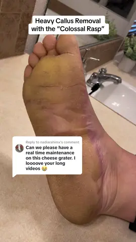 Replying to @nadiarahimx #asmrfeet real-time footage 🥰 #callousedfoot #callusedfoot #footcallus #footcallusremover #footcallusremoval #footcalluses #callousremoval #callousremover #footrasp #crackedheel #crackedheelstreatment #parmeseanpalms #parmesanpalms  @ParmesanPalms 