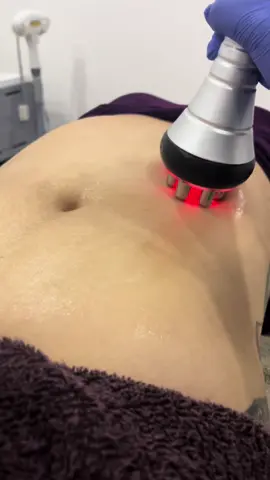 ¿Ya conoces todos los beneficios que tiene ma radiofrecuencia corporal? ❣️ Es nuestro compelmento favorito para todos nuestros tratamientos de aparatología, en especial cuando se trata de eliminar la flacidez ✨ - #radiofrequencia #radiofrequency #reafirmarabdomen #moldeadocorporal #aparatologia #aparatologiaestetica #flacidez 