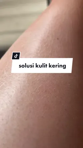 kulit kering sampe bersisik? JANGAN DIBIARIN! harus dimoisturize 😭👎🏻 #skincare #dryskin #kulitkering #mireyabodywash @Mireya Cosmetics 