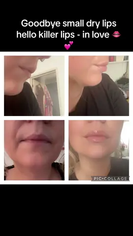 I am OBSESSED with this lip treatment. Finally a product that actually works and moisturises my lips at the same time! #smalllips #biglips #lipinjetions #lipfiller #lipfillercheck #natural #liptreatment #treatment #lipplumper #moisturise #hydrate #BeautyTok #beautyhacks #BeautyReview #killerlips #lipkiller #soinvogue #productreview #musthaves 
