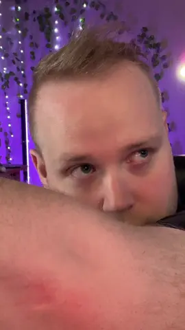 Wow! Both my forhead and I are in awe! 