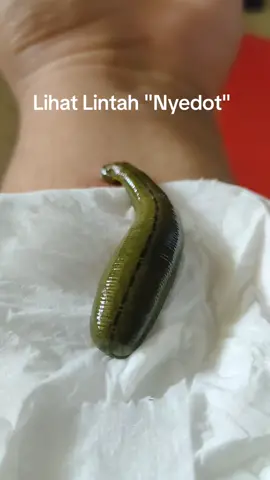 Si Mr Lintah sedang asik makan. si lintah selain menyedot, dia juga memasukkan berbagai enzim ke dalam tubuh kita. salaha satu nya hirudin yg bermanfaat tuk memgencerkan da rah yg kental #terapilintahmalang #terapilintah #leechtherapy #hirudotherapy #malanghits #malangterkini #healthylife #gayahidupsehat #viral 