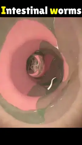 3d animation of intestinal worms🪱 #asmr #trending #foryou #xuhuong #xuhuongtiktok #funny