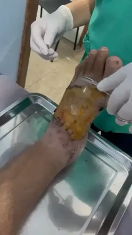 #saúde #moto  #tecnologia #medicina              Dr Felipe  Vicente , Realização Técnica de figueiredo!!