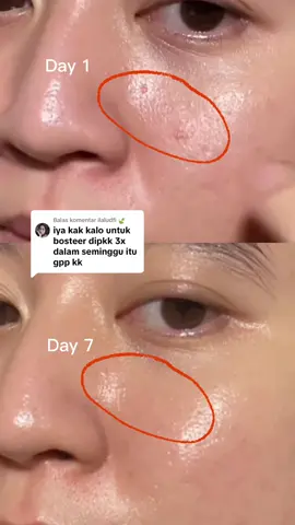 Membalas @ilaludfi 🍃   | aku udah nyobain bener2 rutin skrg bisa kasi testimoni lngsung ❤️🥰 hasilnya bener2 mantep, bruntusan mulai memudar terus bekas jerawat merah aku perlahan juga ilang dapet bonus kulit lebih cerah juga 🥰😭 pokoknyaaaa sukaaaa banget sama jelly booster the originote ini 🫶🏻 The originote 24k symwhite jelly booster