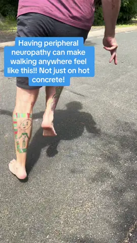 TOO HOT. WATCH OUT. #everybodyhealing #acupuncture #needtoknow #fyp #funny #peripheralneuropathy 