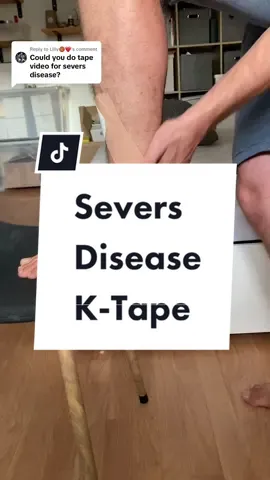 Replying to @Lilly🏀❤️  How to tape for Severs Disease. Follow to declare war on your heel. #seversdisease #heelpain #fyp 