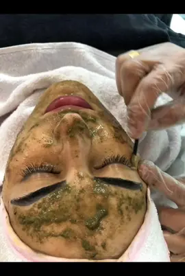 Antes e depois peeling Rose de Mer #  #peeling #antesedepois #phenolpeel #peelingskin #peelingalgas #rosedemer #marmorto #foryou #foryoupage #viral #rosedemerpeeling #rosedemerisrael 