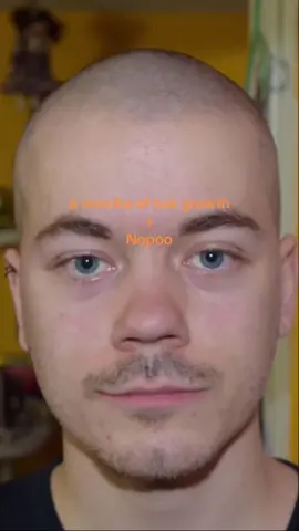 6 months of hair growth 🤗👱‍♂️ #hairgrowth #timelapse #nopoo #noshampoo #noshampoochallenge #buzzcutgrowth #6monthshairgrowth #6months #viral #trending #fy #fyp #foryou #foryoupage