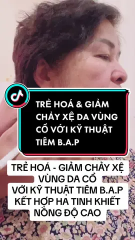 🌱Trẻ hoá, nâng cơ, cải thiện tình trạng “cổ gà” cho da vùng cổ với kỹ thuật tiêm BAP và HA tinh khiết nồng độ cao #trueskinvietnam #trueskinmedispa #trueskin #lovetrueskin #tiêm_bap_5_điểm_sinh_học #neckrejuvenation 