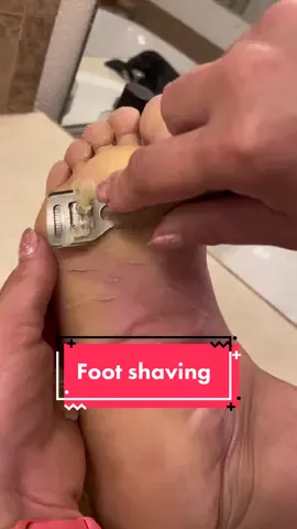 #parmeseanpalms #asmrfeet #callousremoval #footcallusremoval #parmesanpalms #callousedfoot #footcallus #podologia #podiatry #footcalluses #callousremover #callusshaver #footcallusremover #dermatology 