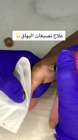 التقنيه السحريه لكل عيوب البشره🌟 #explore #خميس_مشيط #كاموفلاج_ابها #أبها_عسير #fyp #exploremore #جازان #السوده 