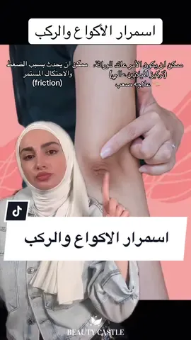 خطوات لعلاج اسمرار وخشونة الاكواع والركب. #beautycastle_lb #اسمرار_الاكواع #اسمرار_الركب #اسمرار_الكوع_والركبة#تفتيح_إسمرار_الاكواع_الركب 