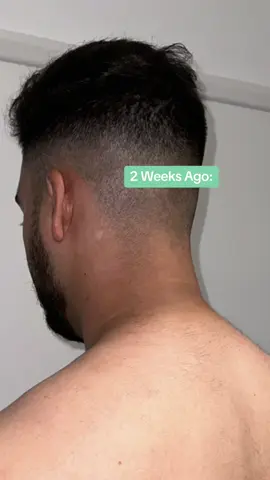 Best product for unwanted darkness on face & body✨ #foryoupage #foryou #trending #acne #acneskin #skin #skincare #clearskin #hyperpigmentationtreatment #desi 