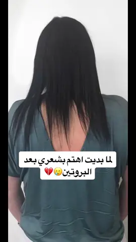 موجود عرض اذا ما فادك ترجعي فلوسك✅🤍 ضمان3 شهور الزيت مميزاته تشوفينه بدا يطول بعد اسبوع وتشوفين النعومه وازاله التقصف وتغذيه الشعر وكثافه وبعد ثلاث اشهر بتشوفين الطول والفرق 💅🏼✅ #تطويل_الشعر_ونعومة_مثل_الحرير #تطويل_الاظافر #تطويل_الشعر_علاج_تساقط_الشعر #تطويل_الرموش_وتكثيفه #تطويل_الرموش #تطويل_شعر #تطويل #زيت_شعر 