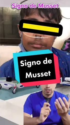Signo de Musset, insuficiencia aórtica, semiología, medicina. #musset #signomusset #semiologia #insuficienciaaortica #medstudent #estudiantedemedicina #medicina #internado #enfermeria #enarm2023 #mediclasesfácil 