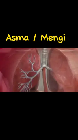 Asthma Attack Animation #asma #mengi #asthma #paru #alergi #polen #fyp #fypシ゚viral #animation 