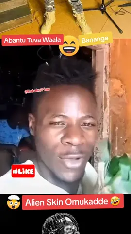 Alien 👽 Skin Back In The Days ...Banange Tuva Wala  #fyp #fypシ #fypシ゚viral #foryoupage @AlienSkin ug #foryou #bitcoin 