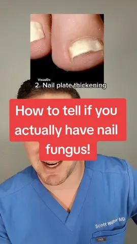 Replying to @mr.murtle1 Here's how to tell if you actually have nail fungus! What other questions do you have? #toenailfungus #nailfungus #onychomycosis #dermhacks #toenail #todayilearned #dermatology #microbiology 