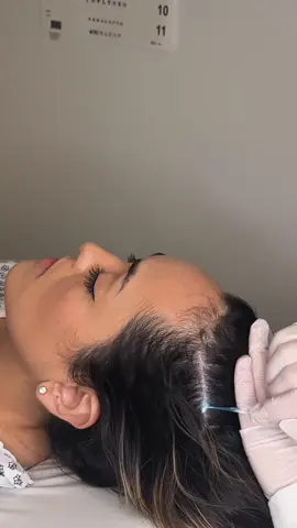 ASMR scalp check for @Ivy B ASMR best medical roleplay to help you fall asleep fast | sharp or dull scalp exam for sleep and relaxation #asmrhairsounds #asmrhair #asmrrealperson #asmrsharpordull #asmrmedical #asmrvideo #asmrdoctorroleplay #asmr #madpasmr #asmr_tingles #asmrsounds #asmrsensory #asmrroleplay #asmrmedicalexam #asmrdoctor 