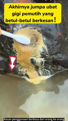 RM13.3/pc, 21 hari ubat gigi pemutih probiotik menyelamatkan gigi anda, melindungi kesihatan pergigian anda#oralshark#kesihatanpergigian#ubatgigipemutih