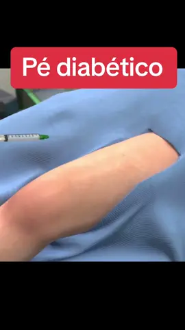 #pediabetico #diabete #diabetes #fy #foryou #viral #fy #foryoupage #usa #usa🇺🇸 #brasil🇧🇷 #_jamillymonteiro #pediabeticos 