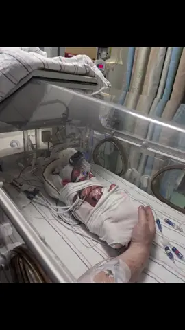 Time is flying by yet I feel like I'm missing everything. I hate watching them grow inside a box. I hate only getting to cuddle them around an hour sometimes every other day. The girls are one month old today! They are making slow but steady progress towards busting outta there. We can't wait. #nicu #nicujourney #nicustrong #onemonthold #timeflies #identicaltriplets #identicalgirls #monochorionictriamniotictriplets #nicumom #growbabiesgrow 