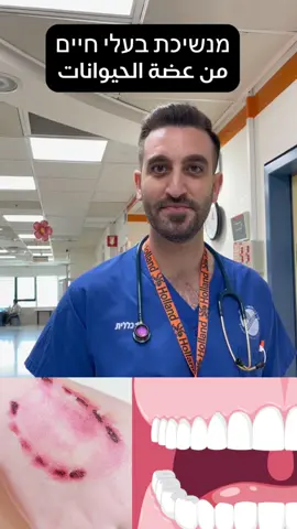 נשיכת בן אדם מסוכנת ❗️ عضة الانسان خطيرة ❗️יכול לגרום לזיהום חיידקי מקומי קשה (הפה של בן אדם מכיל מליונים של חיידקים) מלווה בדלקת בגידים ובעצמות ונדיר יכול לגרום למוות. يمكن أن يسبب عدوى بكتيرية موضعية شديدة (فم الشخص يحتوي على ملايين البكتيريا) مصحوبًا بالتهاب في الأوتار والعظام ونادرًا ما يتسبب في الوفاة.