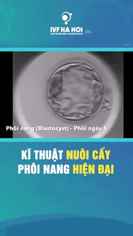 Phôi được nuôi cấy trước khi chuyển vào tử c.ung người mẹ như thế nào? Các ba mẹ hãy xem để hiểu thêm nhé 🥰 #ivfhanoi #ivfbaby #vosinhhiemmuon #vosinhhiemmuonnugioi #mongcon #mongconhiemmuon #fyp #ivf #xuhuong #xh #xuhuongtiktok 