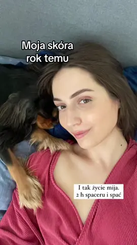 Tak zwane życie 🥲 #trądzik #skóratrądzikowa #teksturaskóry 