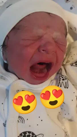 #crybabies #babytiktok #yenidoganfotograf #newbornsleep #bebeklerim #hamileyimanneyim #jinekologmuratkayaoglu #jinekologdrmuratkayaoglu #yenidoğan #yenidogan #küçükbebek #bebekvideolar #küçükmucize #newbornglow #bebekler #newbornvsnowchallenge #normaldoğum #sezaryendogum #newbornscrunch #newbornsession #newbornsafety #newbornshoot😍 #newbornstage #newbornstretch 