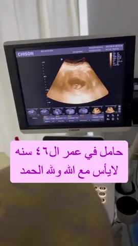 #نسائيه_اطفال #طبيبه #عقم_وانجاب #حمل #ليزر #تحديدجنس_الجنين♂️♂️ 