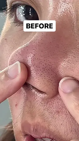 Cleansing Balm Terbaik Yang Pernah Aku Coba Seumur Hidup😭 Gaboong, Gak Lebay, emang beneran bagus banget parah!💯