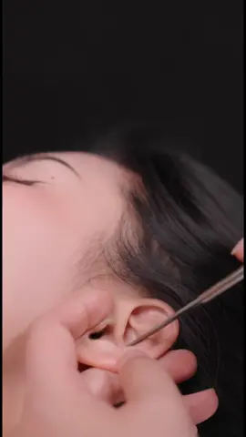 It is traditional Chinese ear wax service #spa #asmr #comfortable #mind #earwax #relax #trending #viral #china