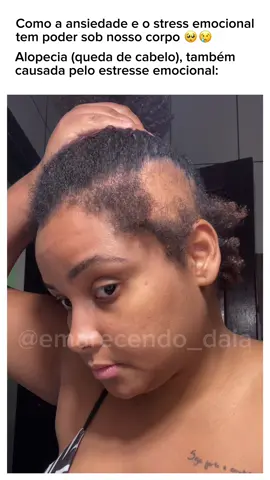 #emagrecimento #quedacapilar #cabelos #crespo #yberaparis #antesdepois #hair #emocional #depressa #ansiedade #viral #emagrecer #tiktoker 