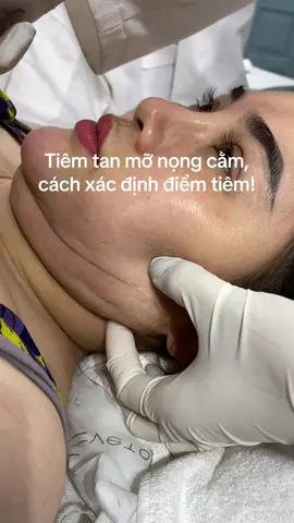 mỡ sẽ đào thải qua đâu? liệu tiêm tan mỡ có hiệu quả như qc?