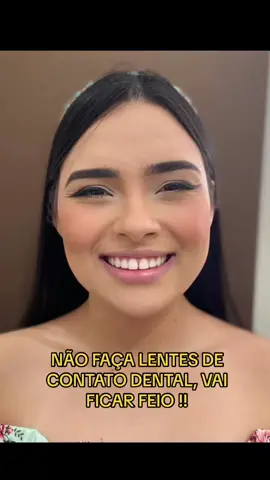 Lentes em resina sem desgaste 😍😍  #lentesemresina #fyp 