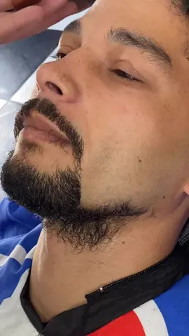 Barba de minoxidil?? #barba #beard #cavanhaque #bigode 