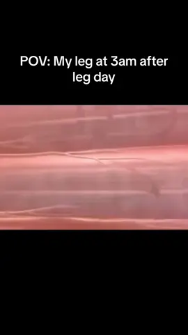 The hamstring cramp goes crazy. #sports #athlete #fyp #zyxcba #musclecramps #funny #fypシ #CapCut #3danimation 