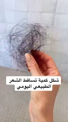 كم تتوقعون شعركم يتساقط يوميا؟ بناء عالفيديو #اكسبلور #تساقط_الشعر #foryoupage #fyp #foryou #fypシ #explore #viral #viralvideo 