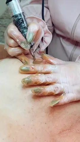 Reconstrução da Auréola Mamária  #camuflagem #paramedica #reconstrucaomamilo #foryou #fyp #estetica #micropigmentacao 