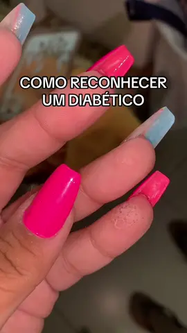 Meu dedinho fica assim após o banho kkk #TikTokMeFezOuvir #diabetes #sintomasdediabetes 