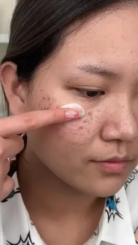 Friends with spots on their faces must useit!#whiteningfrecklecream #cindynal #fyp 